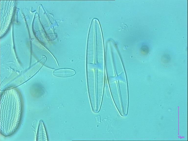 Lemnicola hungarica, (Grunow) F.E.Round & P.W.Basson, 1997 | Sandre 